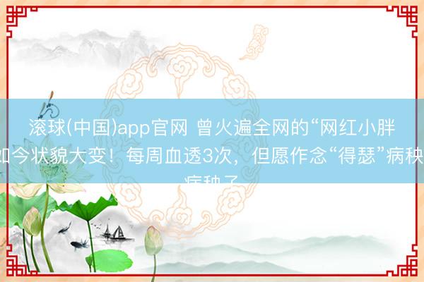 滚球(中国)app官网 曾火遍全网的“网红小胖”如今状貌大变！每周血透3次，但愿作念“得瑟”病秧子