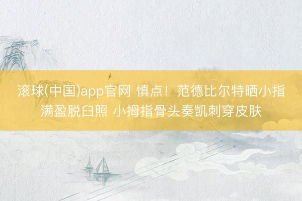 滚球(中国)app官网 慎点！范德比尔特晒小指满盈脱臼照 小拇指骨头奏凯刺穿皮肤